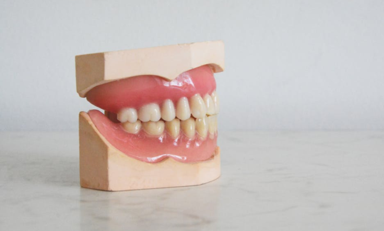 Do You Need to Replace Dentures?